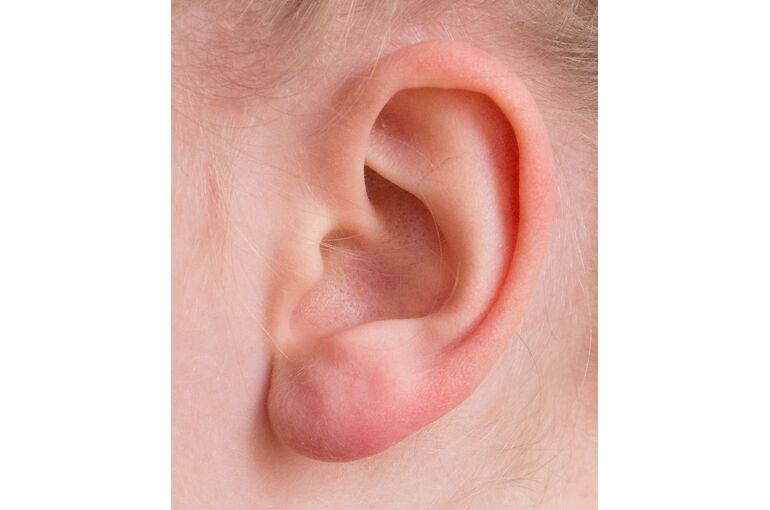 ear-auricle-listen-hearing